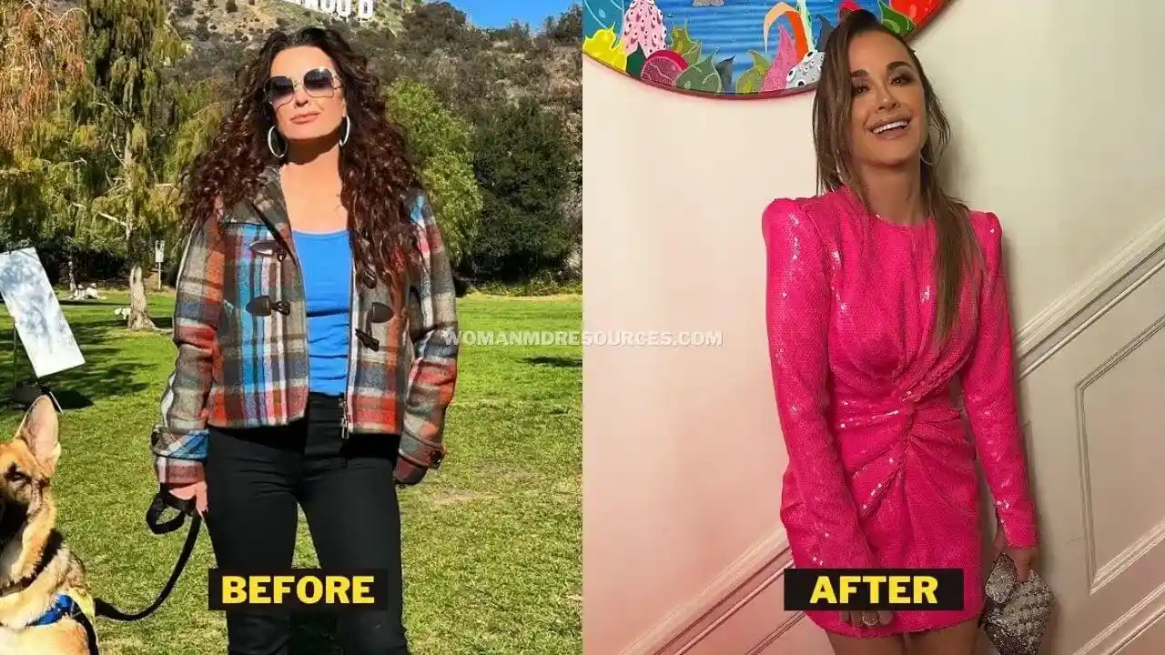 Kyle Richards Weight Loss Diet Workout Surgery And Ozempic Details