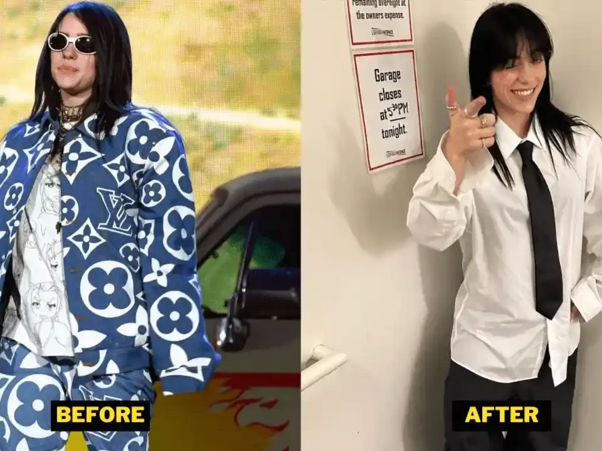 Billie Eilish’s Weight Loss Journey Her Transformation Revealed