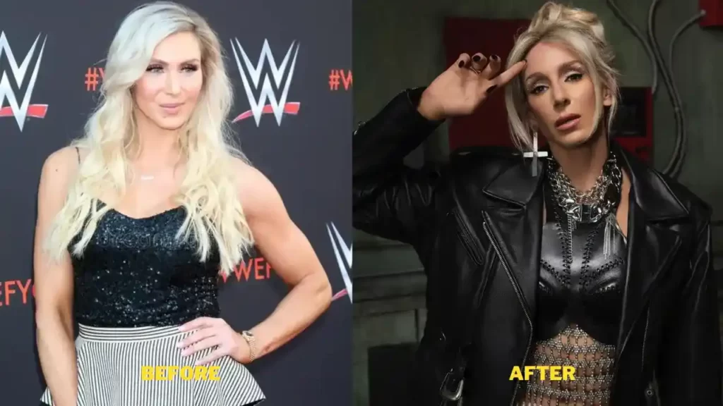 Charlotte Flair Plastic Surgery 2023. Dental, Breast Implants, And New ...