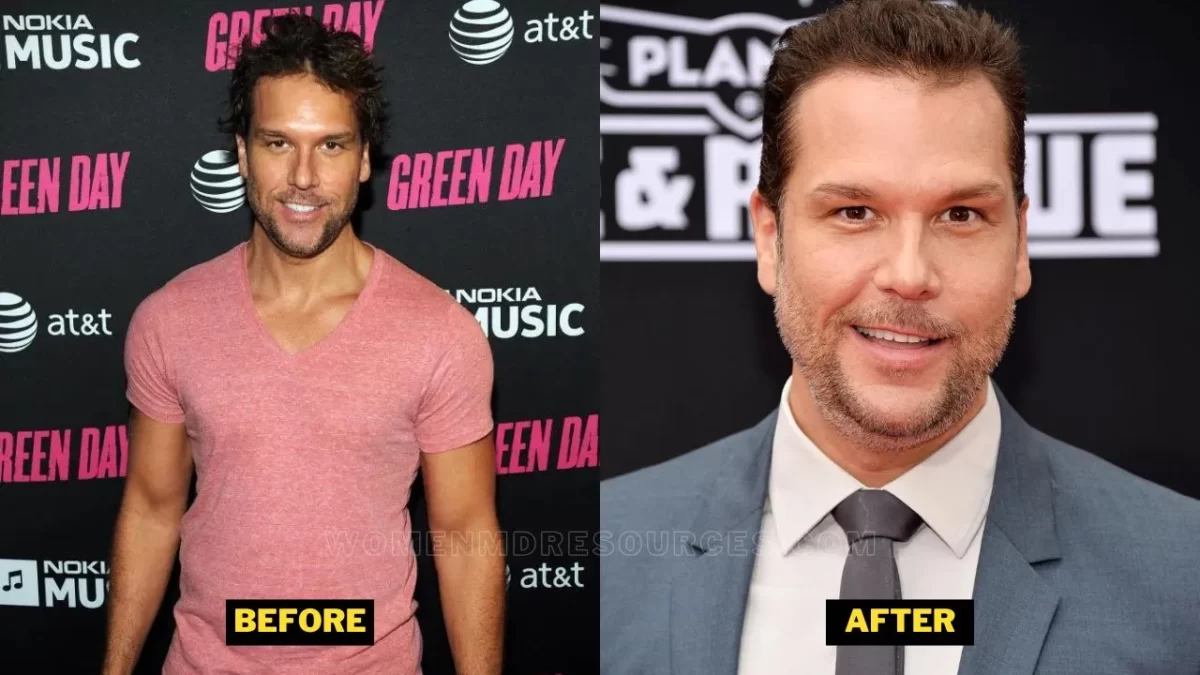 Did dane cook get plastic surgery