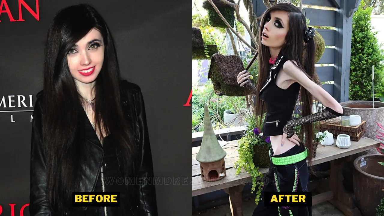 Eugenia Cooney Weight Loss. Struggle Against Anorexia And Death Rumors.