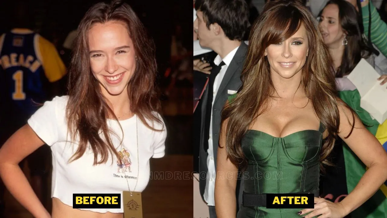 Jennifer Love Hewitt Plastic Surgery