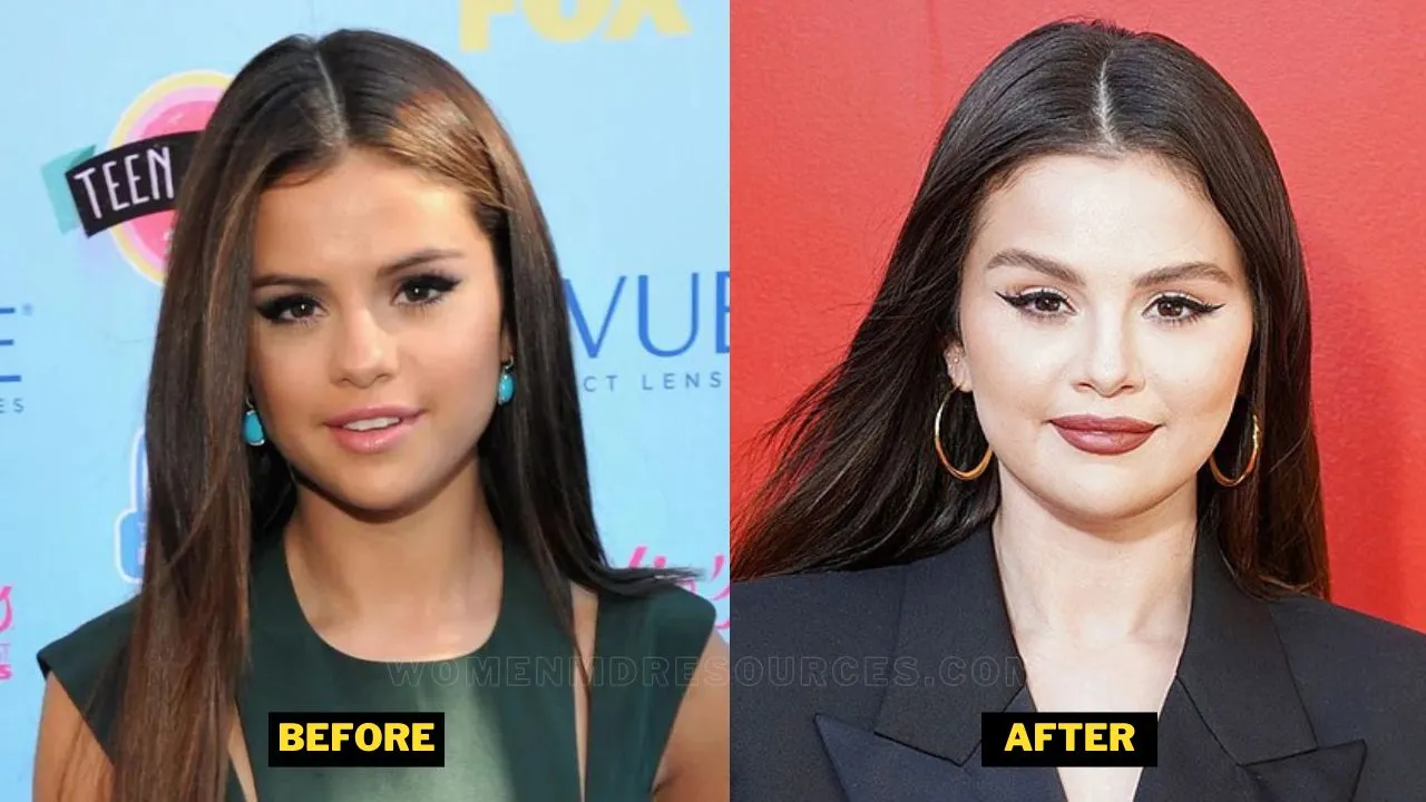 Selena Gomez Weight Gain Before And After