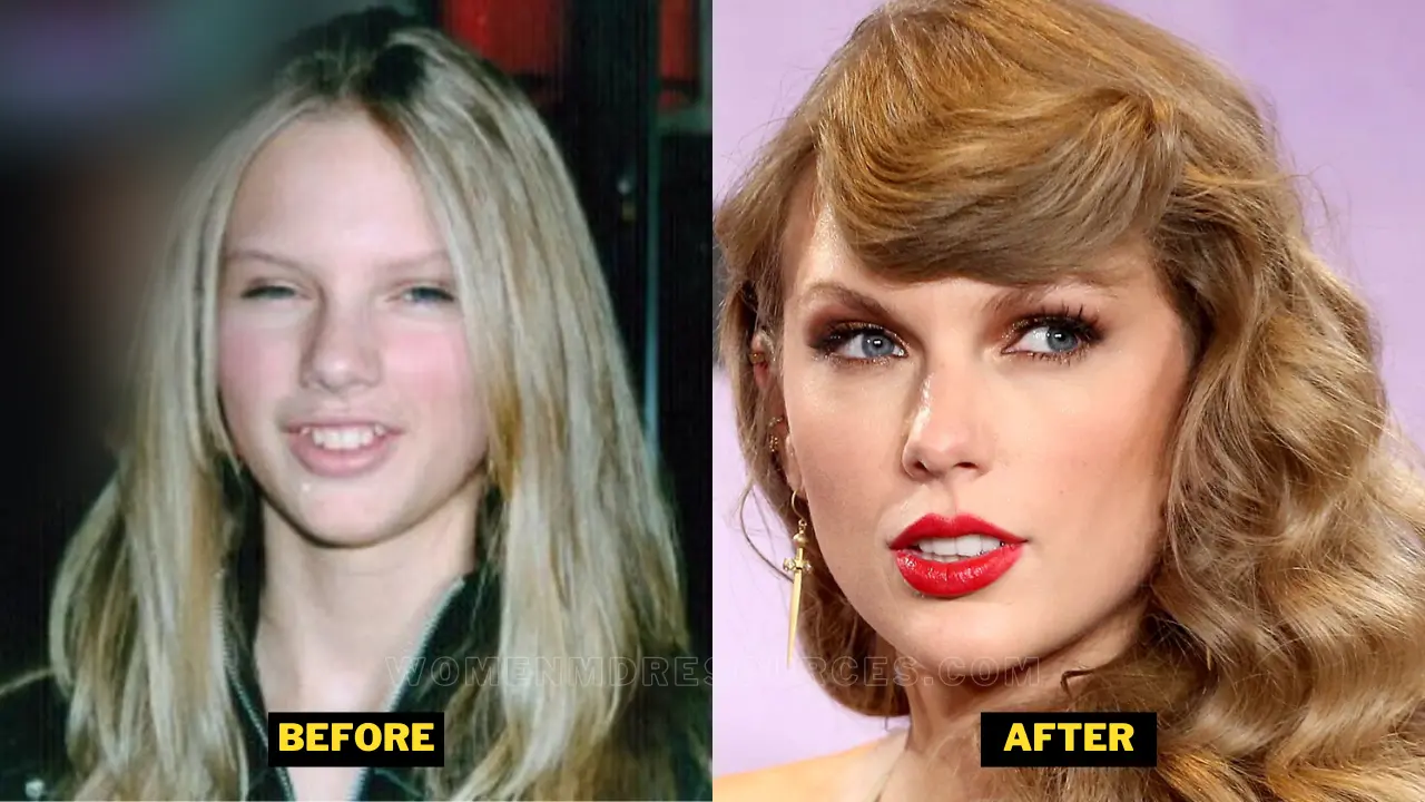 Taylor Swift Teeth Before After.webp