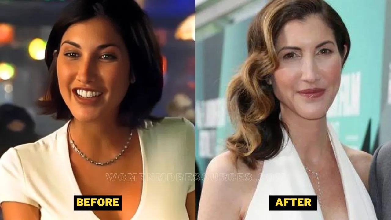 Jackie Sandler Plastic Surgery