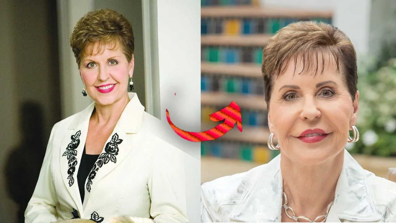 Joyce Meyer Plastic Surgery